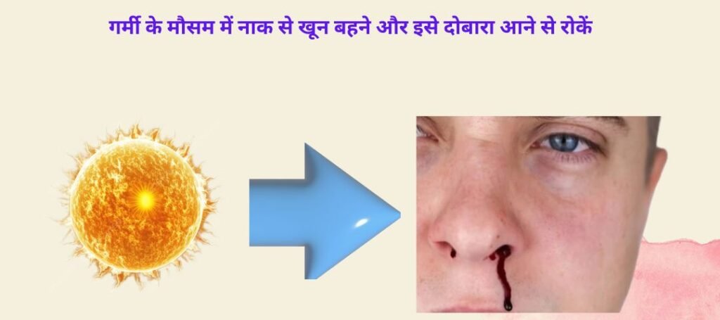 नाक से खून बहने